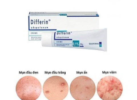 Differin - Lựa Chọn Khi Gặp Các Vấn Đề Về Mụn