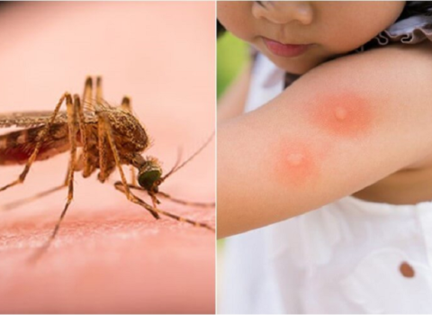 Good experience of a male customer who was bitten by a mosquito at ABC Hoi An pharmacy