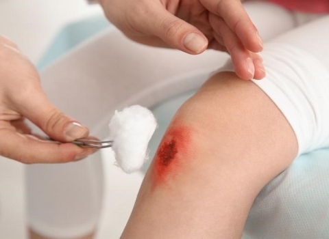 Interesting experience of a male customer with a scratched leg at ABC Hoi An pharmacy