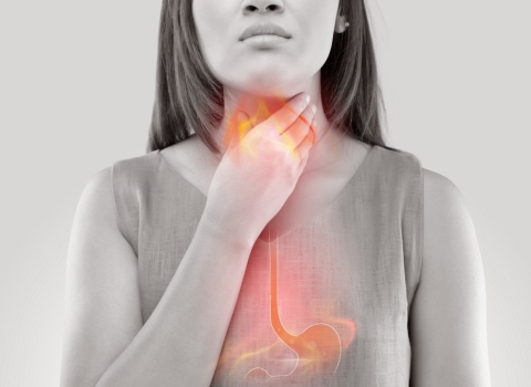 Medicines to treat gastric reflux are often used in Vietnam. ​