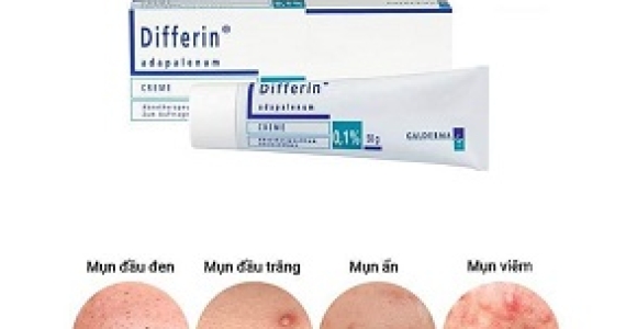 Differin - Lựa Chọn Khi Gặp Các Vấn Đề Về Mụn