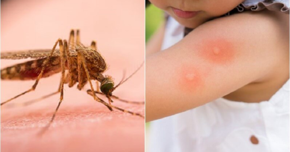 Good experience of a male customer who was bitten by a mosquito at ABC Hoi An pharmacy