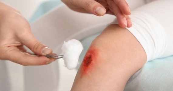 Interesting experience of a male customer with a scratched leg at ABC Hoi An pharmacy