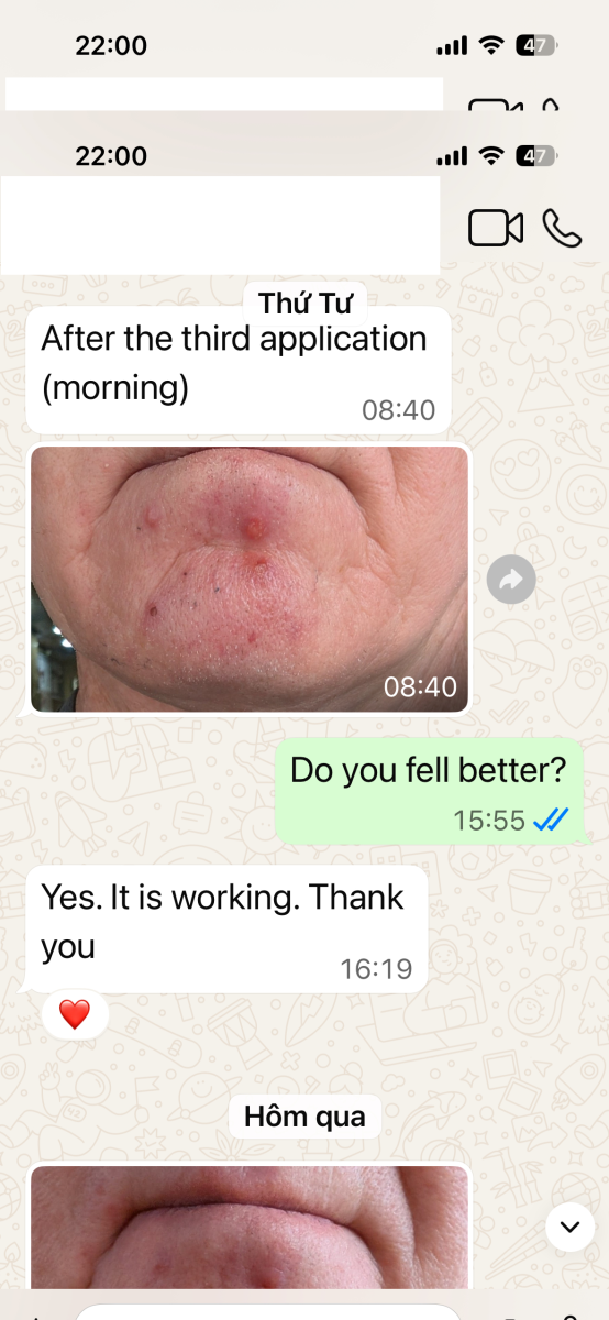 ABC Pharmacy follow-up support customer