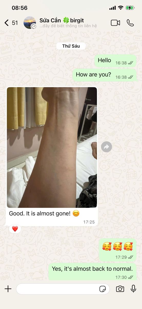 ABC Pharmacy Da Nang follow-up care message showing jellyfish sting rash almost back to normal after pharmacist guidance