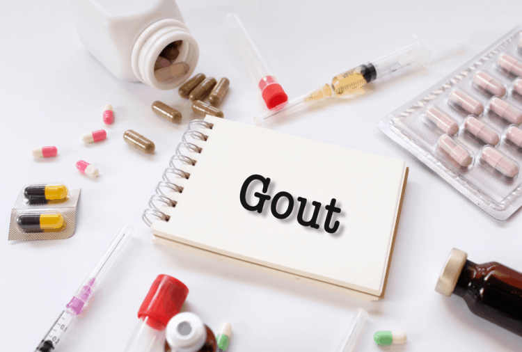 bien-chung-benh-gout-abc pharmacy da nâng