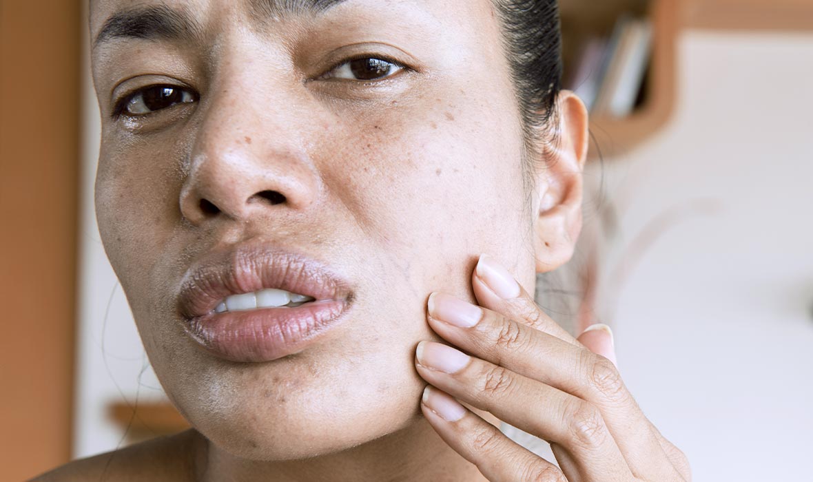 mãn kinh có biểu hiện gì 